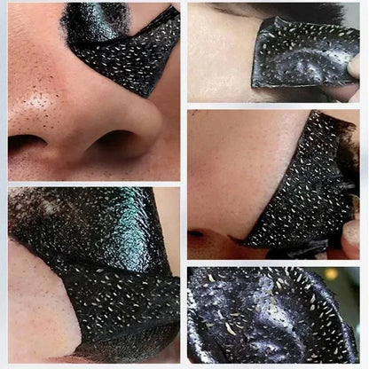 LANBÉNA Blackhead Removal Mask